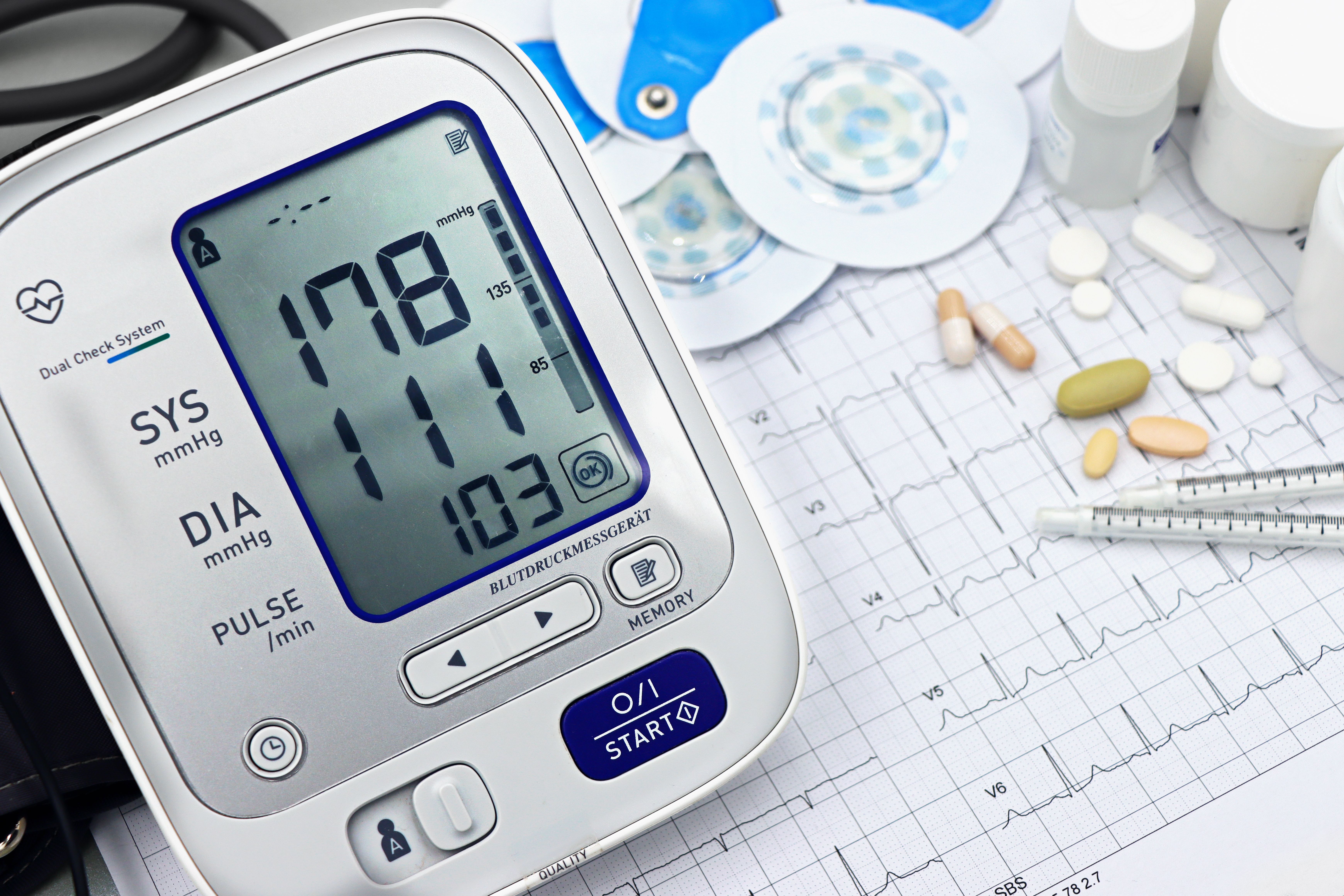 Close-up of a digital blood pressure monitor with ECG printout, pills, and medical tools. — Foto: Marta Branco / Pexels